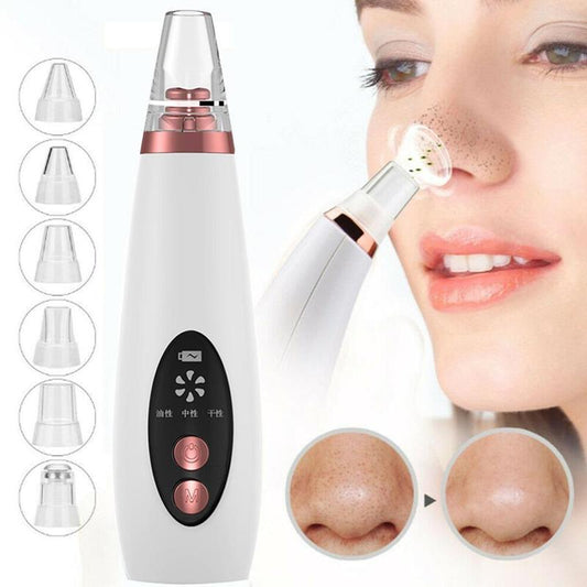 Blackhead Pore Vacuum Remover & Face Suction Tool